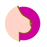 Retracción del pezón (hundimiento)